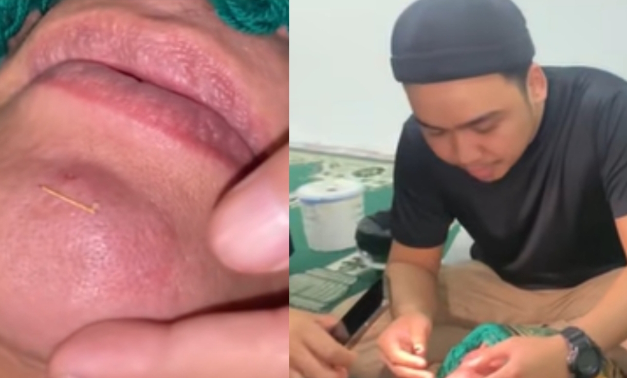 Artis Lelaki Buang Susuk Emas Puluhan Tahun, Nekad Bertaubat Demi Tenang Jiwa