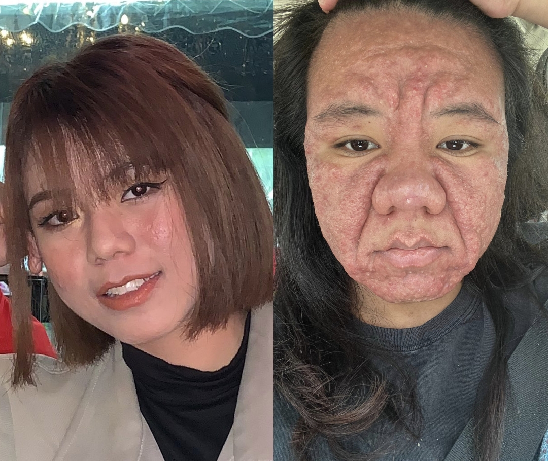 Wajah Semakin Hodoh Ketika Mengandung, Tak Sangka Suami Dia Sanggup Lakukan Perkara Ini